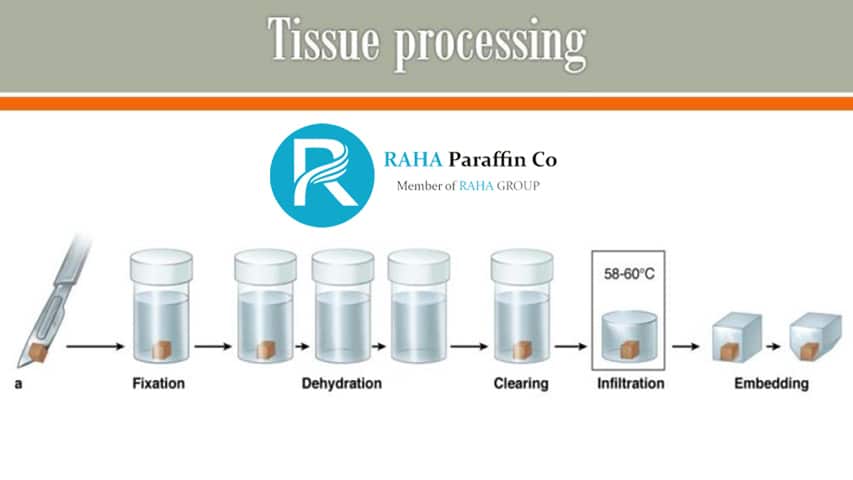 paraffin tissue block